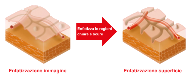 Enfatizzazione superficie (SE)